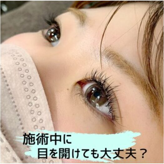 施術中に目を開けても大丈夫？