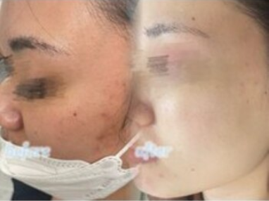 肌悩みはハーブで解決！